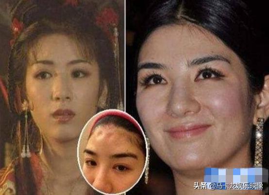 盘点整容后不敢认的女星颜值巅峰（细数整容失败的女明星）(2)