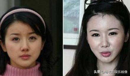 盘点整容后不敢认的女星颜值巅峰（细数整容失败的女明星）(3)