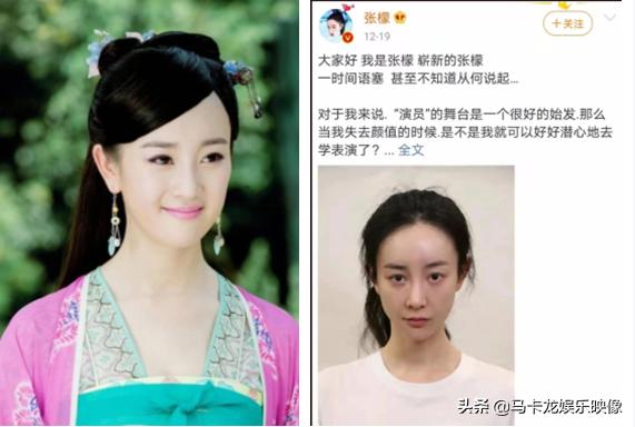 盘点整容后不敢认的女星颜值巅峰（细数整容失败的女明星）(8)