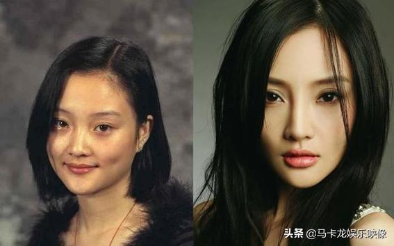 盘点整容后不敢认的女星颜值巅峰（细数整容失败的女明星）(4)