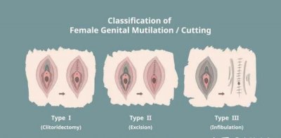 ​割礼是割女性什么部位，印度割礼是什么意？