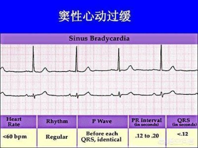 ​年轻人窦性心动过缓有危险吗 儿童窦性心动过缓有危险吗