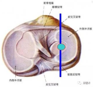 ​半月板解剖及损伤的详细图解